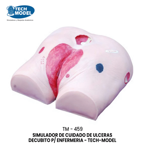 TM-459 Decubitus Ulcer Care Model