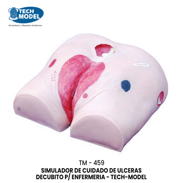 TM-459 Decubitus Ulcer Care Model
